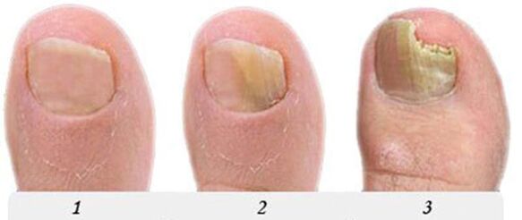 Mushroom growth process on your thumb
