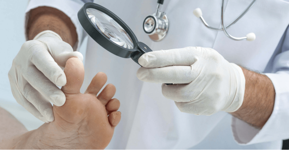 The first symptoms of the mushroom on the leg