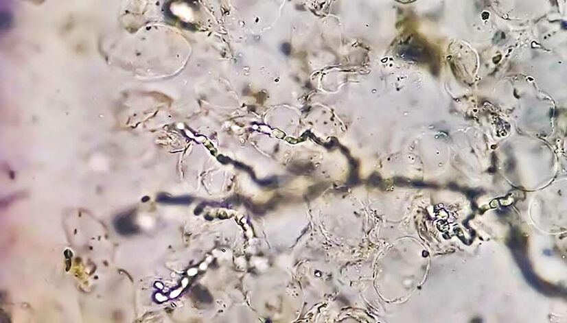 Fungi under the microscope – the culprit in developing mycosis of the feet